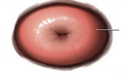 Các bệnh lý nguy hiểm ở cổ tử cung: Bạn gái không nên bỏ qua!