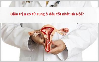 Điều trị u xơ tử cung ở đâu tốt nhất Hà Nội?