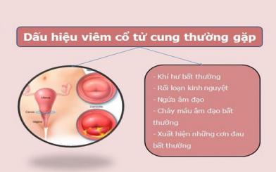 Cảnh báo dấu hiệu viêm cổ tử cung nguy hiểm thường gặp