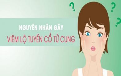 Tìm hiểu nguyên nhân viêm lộ tuyến cổ tử cung thường gặp