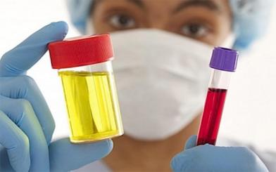  Hiện tượng đi tiểu ra máu tươi ở nữ giới