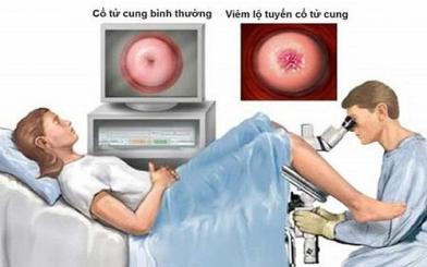 5 bác sĩ chữa viêm lộ tuyến giỏi và uy tín Hà Nội
