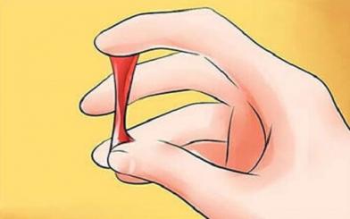 Ra khí hư lẫn tia máu- Bệnh nguy hiểm không thể coi nhẹ