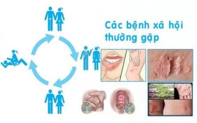 Các bệnh xã hội phổ biến và nguy hiểm nhất hiện nay