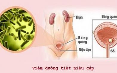 Viêm đường tiết niệu cấp ở nữ nguy hiểm hơn bạn tưởng!