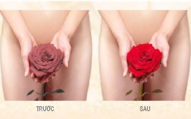 Làm hồng âm đạo tại nhà có thật sự hiệu quả?