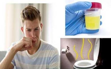 Nước tiểu có mùi hôi nồng nặc ở nam và nữ giới