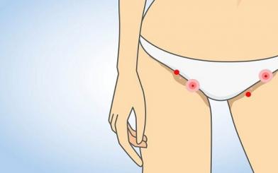 Bị nổi mẩn ngứa ở vùng kín nam, nữ [Kiến thức tổng hợp]