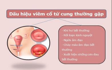 Biểu hiện của bệnh viêm lộ tuyến cổ tử cung qua 3 cấp độ