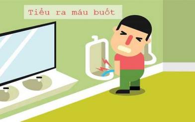 Những điều cần biết về tiểu ra máu buốt [Tổng hợp]