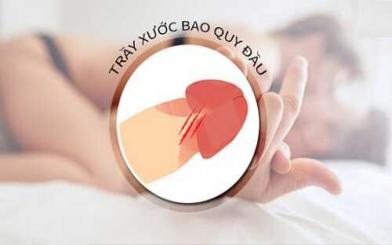 Nguyên nhân xước da bao quy đầu và cách khắc phục