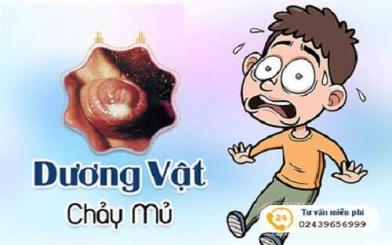 Dương vật có mủ - Dấu hiệu điển hình bệnh lậu