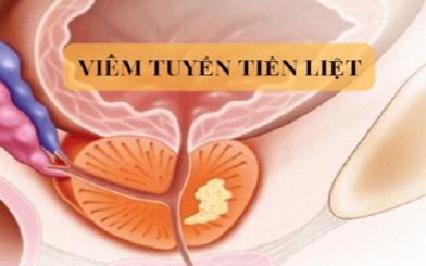 Chữa bệnh viêm tuyến tiền liệt ở đâu? [5 địa chỉ an toàn Hà Nội]