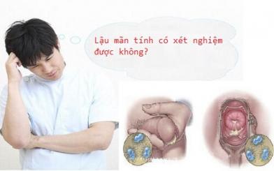 Lậu mãn tính có xét nghiệm được không? 