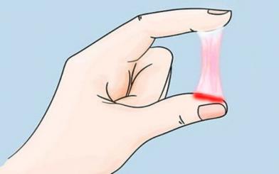 Huyết trắng có máu là bệnh gì và cách khắc phục