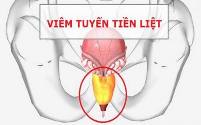 Viêm tuyến tiền liệt nam: Dấu hiệu & cách điều trị hiệu quả