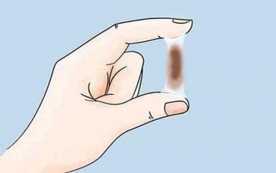 Ra dịch nhầy màu nâu và cách chữa hiệu quả