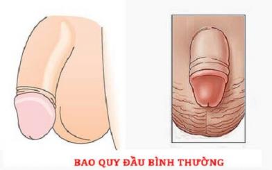 Bao quy đầu bình thường: Cách nhận biết & hình ảnh chi tiết