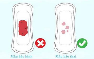 Máu báo thai xuất hiện khi nào? Phân biệt với máu kinh