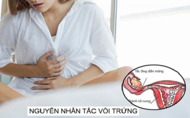 Nguyên nhân tắc vòi trứng và cách khắc phục hiệu quả