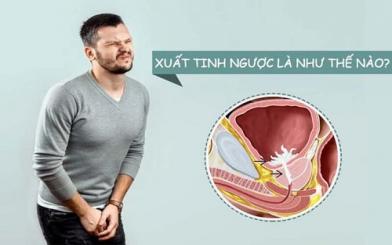 Nhận biết xuất tinh ngược & phương pháp chữa hiệu quả