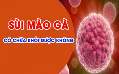 [Giải đáp] Sùi mào gà có chữa khỏi được không?