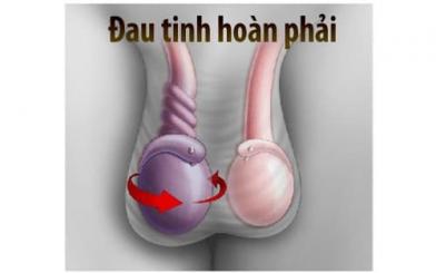 Đau tinh hoàn phải do đâu? Cách điều trị hiệu quả