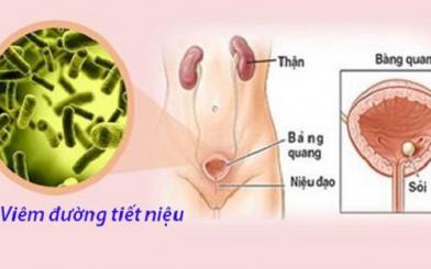 Tìm hiểu về bệnh viêm đường tiết niệu và cách điều trị