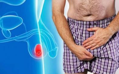 Đau 1 bên tinh hoàn là bệnh gì? Cách điều trị hiệu quả