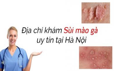 Điều trị sùi mào gà ở đâu hiệu quả? Top 5 địa chỉ đáng tin cậy