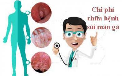 Cập nhật bảng chi phí chữa trị bệnh sùi mào gà năm 2021