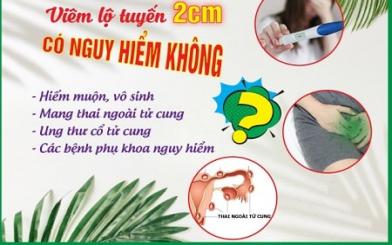 Viêm lộ tuyến 2cm có nặng không và nên xử lý bằng cách nào?