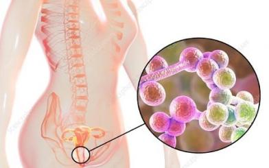 [ Tổng hợp ] 10+ Biểu hiện nhiễm nấm Candida ở nữ giới dễ nhận biết nhất
