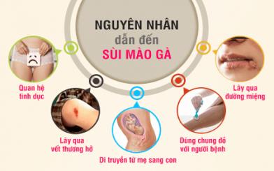[ Tìm Hiểu ] 5+ Cách phòng tránh sùi mào gà hiệu quả và an toàn hiện nay