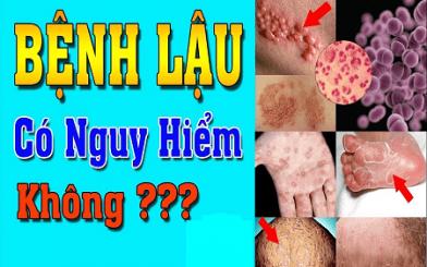 [ Giải Đáp ] Bệnh lậu có nguy hiểm không và chữa cách nào hiệu quả nhất ?