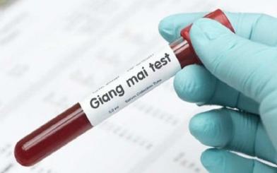 [ GIẢI ĐÁP ] Xét nghiệm giang mai sau bao lâu thì chính xác nhất ?