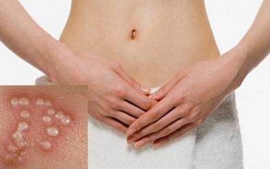 [ Giải Đáp ] Mụn rộp sinh dục có gây vô sinh không và chữa như nào ?
