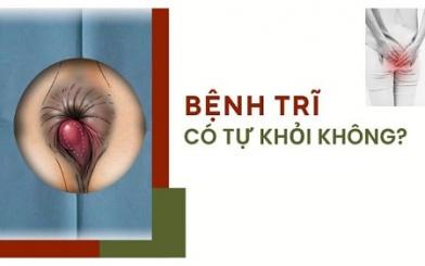 Tổng hợp các triệu chứng trĩ nội dễ nhận biết hiện nay