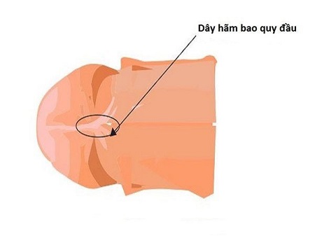 Cách nhận biết bao quy đầu bị dính