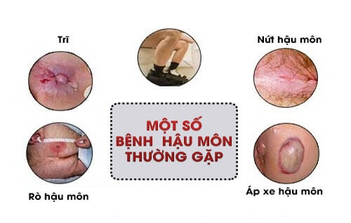 Bệnh lý hậu môn - trực tràng