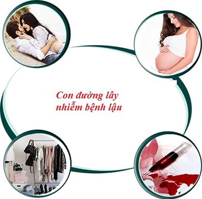 Tìm hiểu những con đường lây truyền bệnh lậu