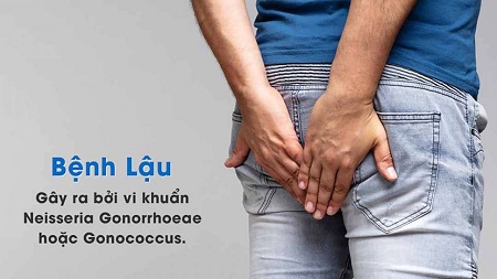 Tổng quan về bệnh lậu 
