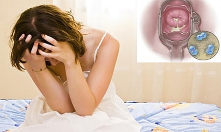 Các thông tin cơ bản về bệnh lậu mãn tính cần biết