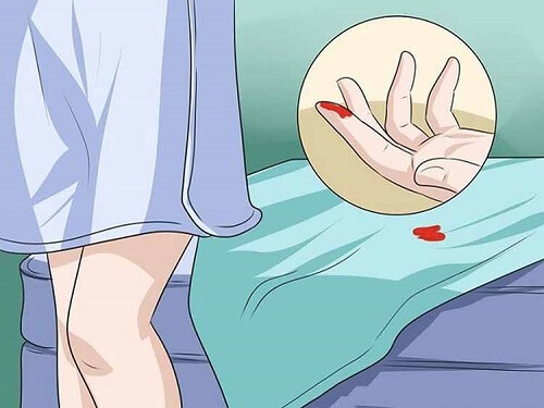 Ra chút máu tươi ở âm đạo (Hình ảnh minh họa)