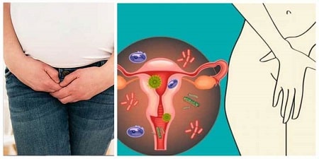 Loại nấm candida khỏi hoàn toàn dứt điểm trước khi mang thai