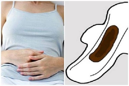Hiện tượng bị ra máu đen sau khi phá thai là gì?