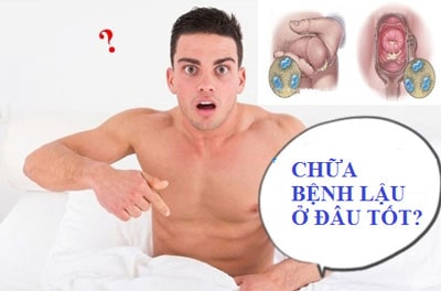 Khi nào cần khám và chữa bệnh lậu