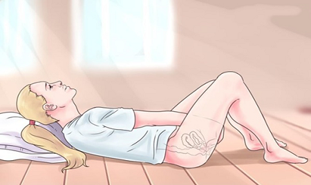 Lưu ý về cách đặt thuốc viêm phụ khoa cần biết