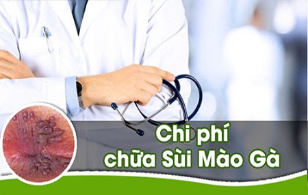 Chi phí tái khám sau điều trị