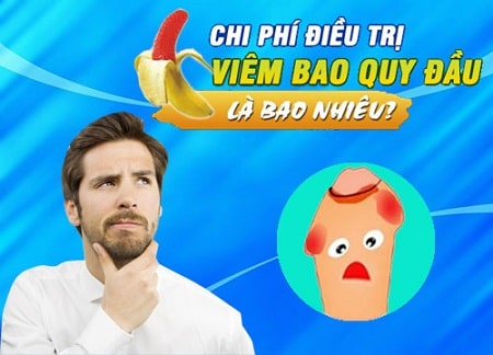 Chi phí điều trị viêm bao quy đầu ở nam giới